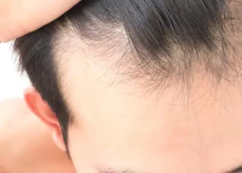 Cientistas fazem crescer cabelo em laboratório e abrem frente contra calvície