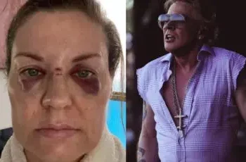 Fã fica ferida após Axl Rose arremessar microfone para plateia em show; veja vídeo