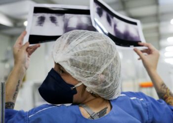 Síndromes respiratórias graves avançam em 22 estados e no DF