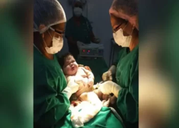 Bebê de 7,3 kg nasce no Amazonas: saiba quais os riscos de dar à luz um filho ‘gigante’