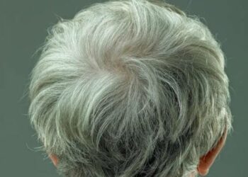 Cabelo branco é reversível, descobrem cientistas dos Estados Unidos