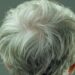 Cabelo branco é reversível, descobrem cientistas dos Estados Unidos