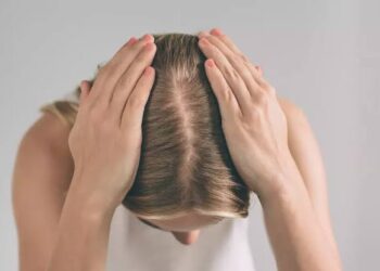 Mulheres contam como é viver com doença que provoca queda de cabelo
