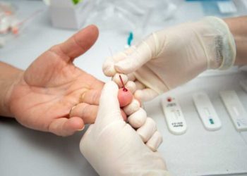 Testes rápidos de HIV e sífilis poderão ser realizados em farmácias