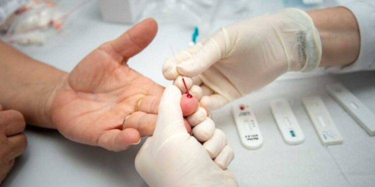 Os novos testes apoiam o acesso à testagens rotineiras (Foto: Pexels)