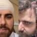 Cantor Zé Neto sofre acidente e mostra cicatriz na cabeça: “Um corte bem grande”