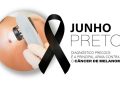 Diagnóstico precoce é a principal arma contra o melanoma, tipo mais agressivo de câncer de pele