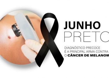 Diagnóstico precoce é a principal arma contra o melanoma, tipo mais agressivo de câncer de pele