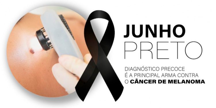 Diagnóstico precoce é a principal arma contra o melanoma
Foto: SESA