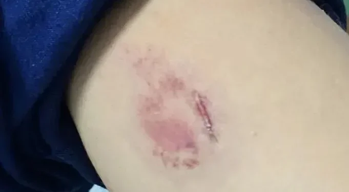 Foto - Reprodução/Poral